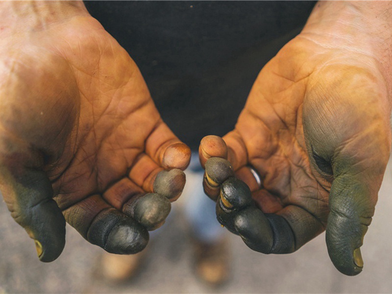 牙疼造句,用牙疼怎么造句子(26句)