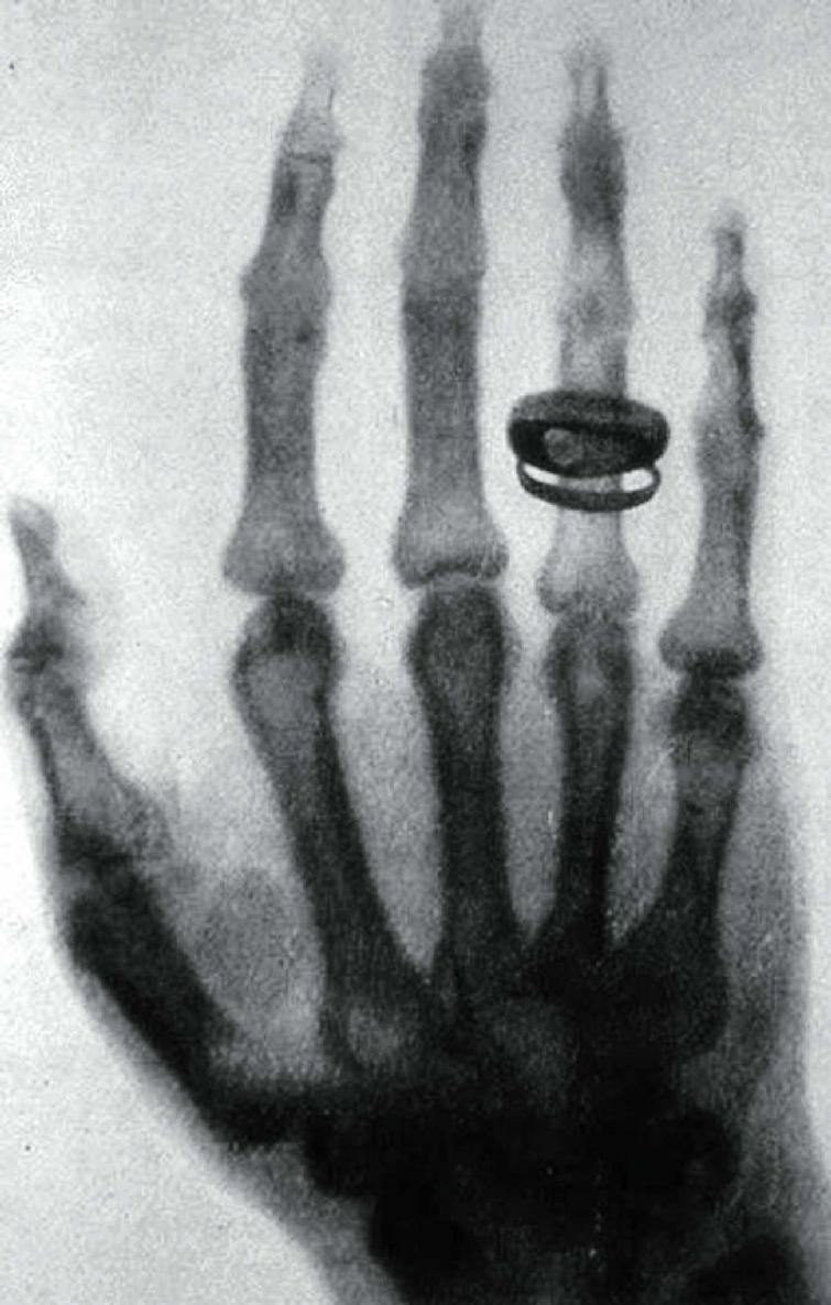 X射线的发现（1901年）-让我们永远铭记伦琴