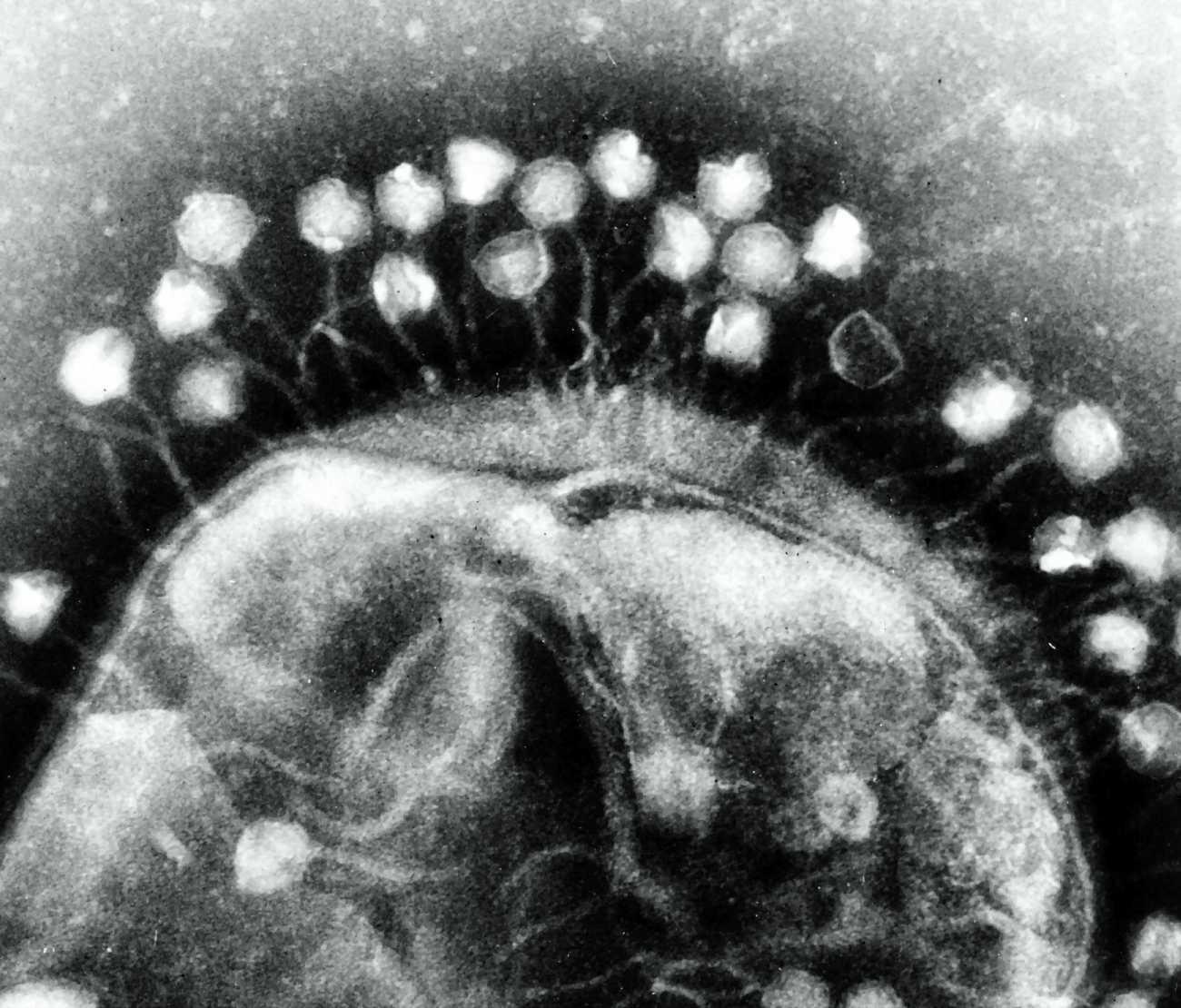 噬菌体的发现（1917年）-细菌的天敌
