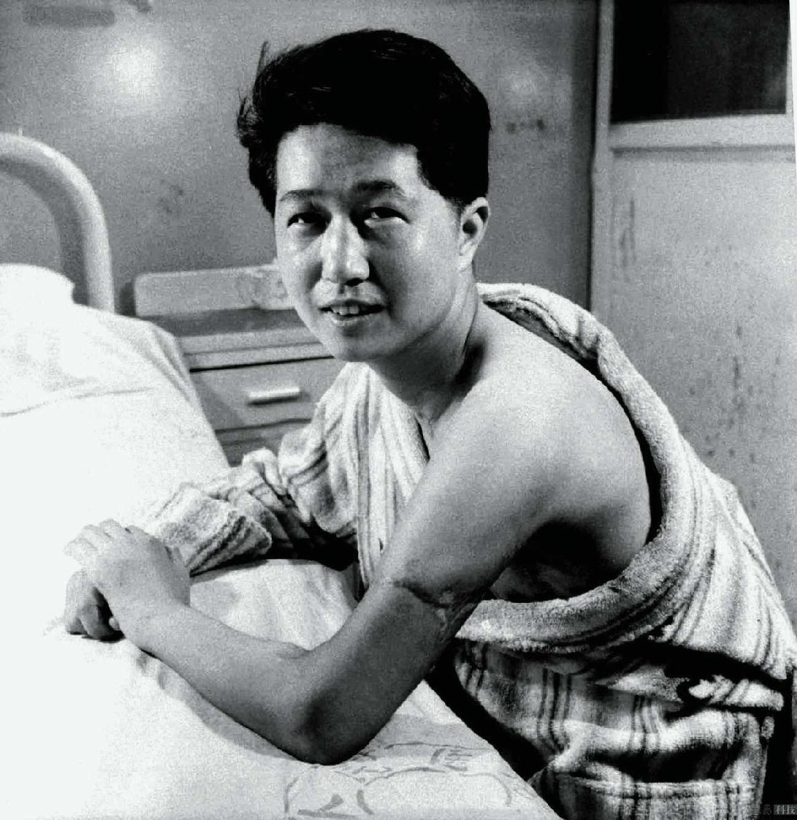 第一次断肢再植（1963年1月2日）-中国医生的创举